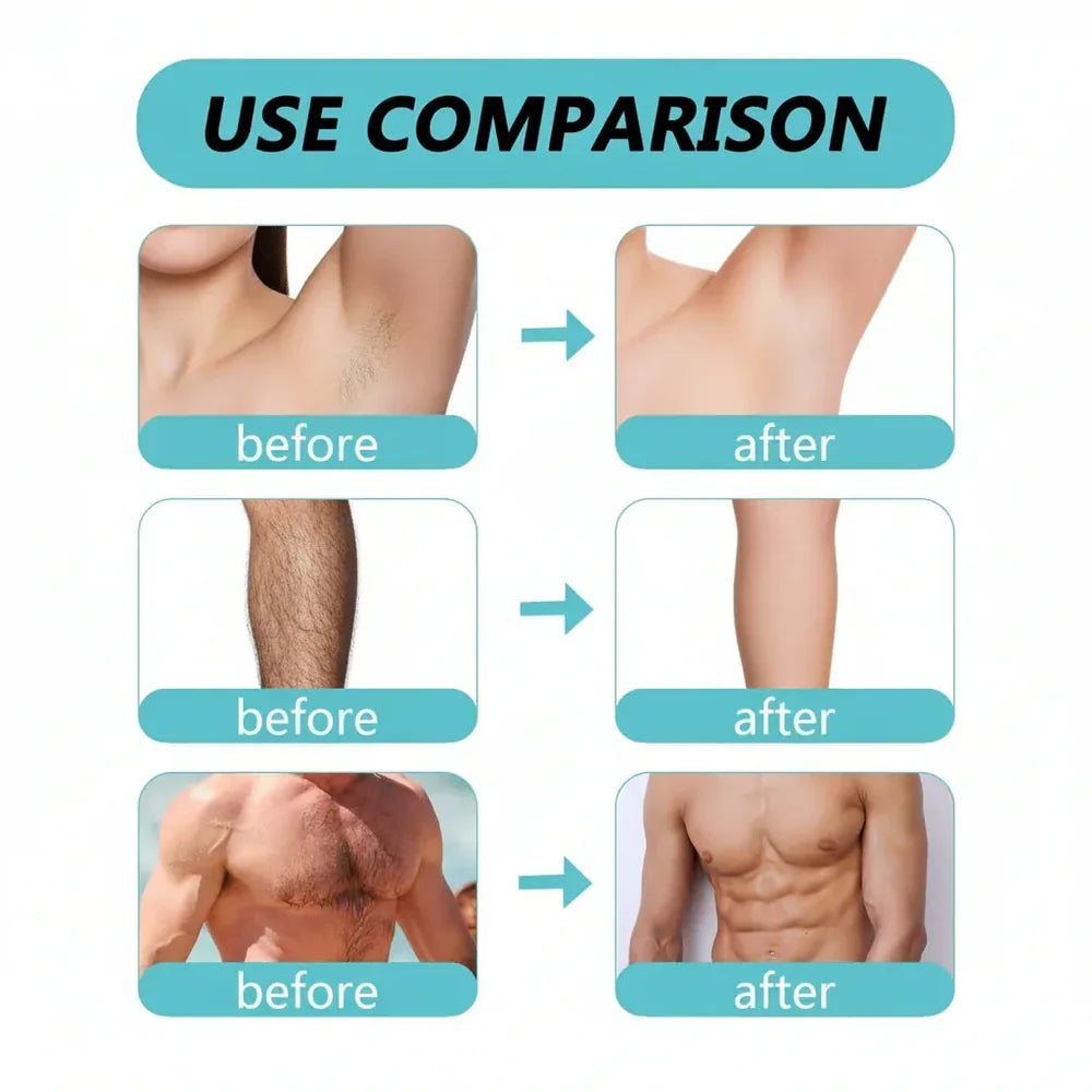 Ecrin Hair Removal Foaming Spray